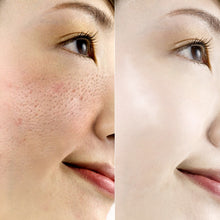 Load image into Gallery viewer, White Rice Serum Skin Care Anti-Acne &amp; Anti Aging Skin Serum